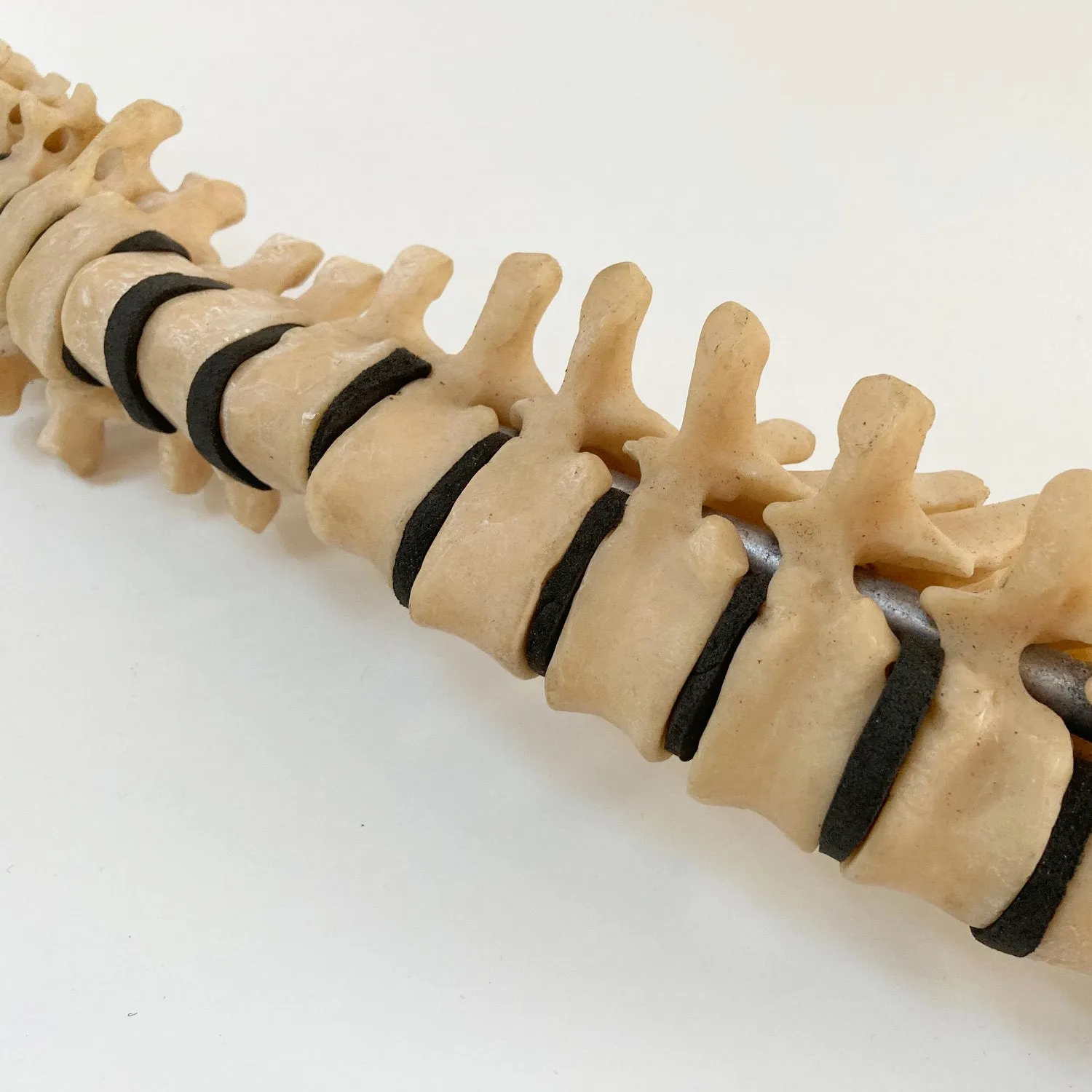 Scoliosis Spinal Column Model by Educational & Scientific Plastics Ltd