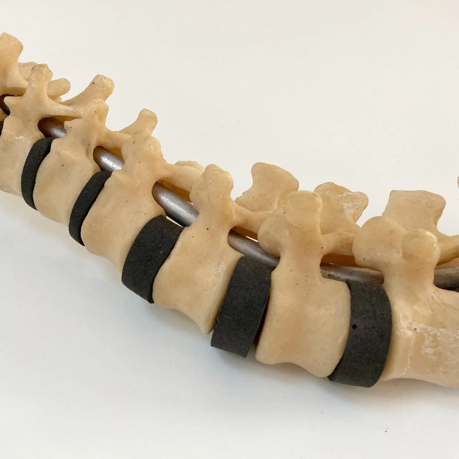 Scoliosis Spinal Column Model by Educational & Scientific Plastics Ltd